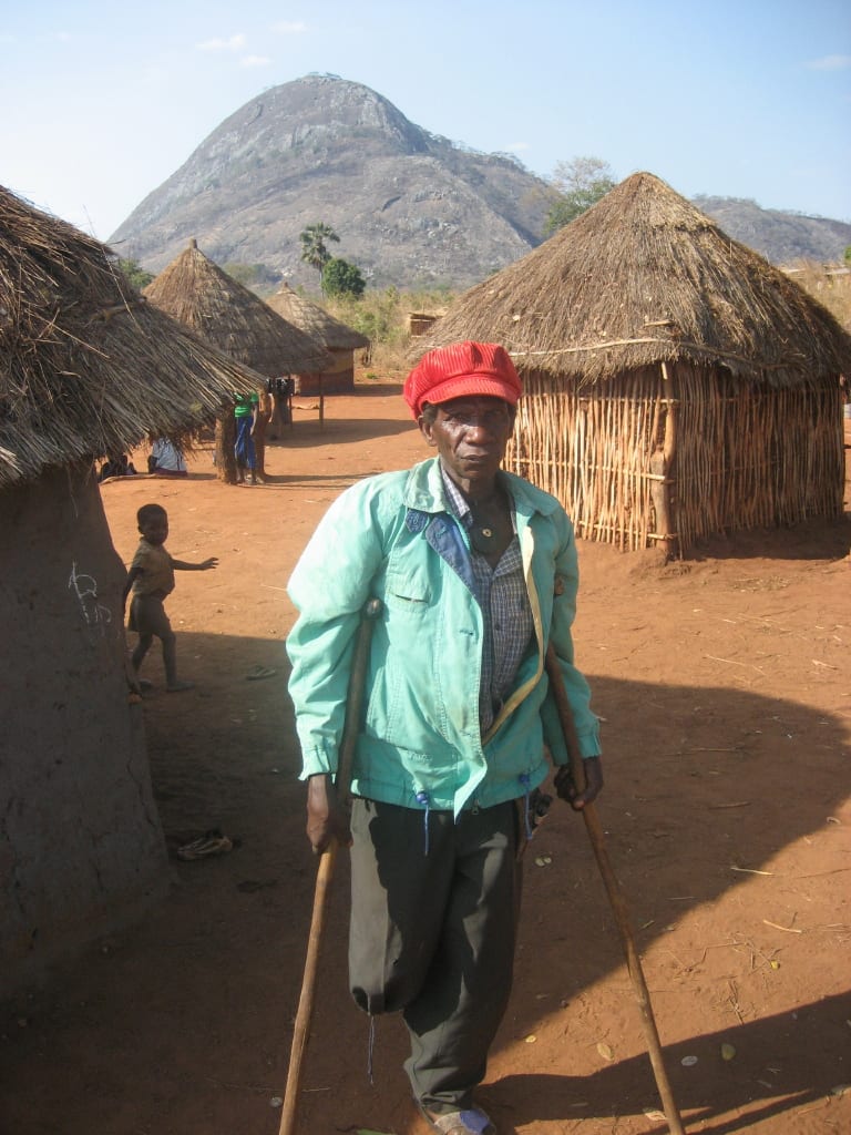 A Mozambican man who has lost a leg to a landmine, standing with crutches
